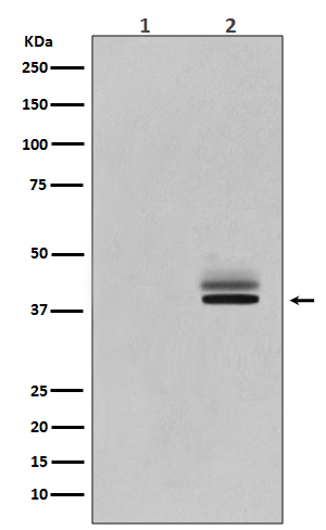 1 - Anti-Phospho-Erk1 (T202/Y204) + Erk2 (T185/Y187) MAPK3 Rabbit Monoclonal Antibody ABO13213