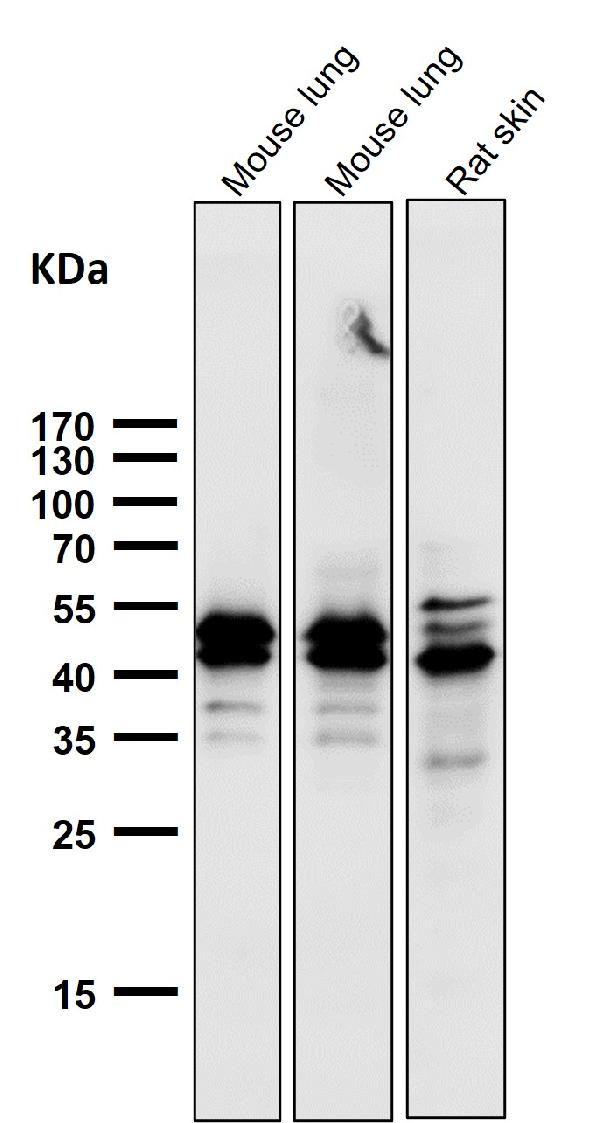 1 - Anti-Phospho-Erk1 (T202/Y204) + Erk2 (T185/Y187) MAPK3 Rabbit Monoclonal Antibody ABO13213