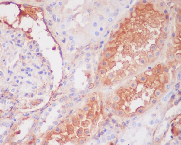 2 - Anti-C9/Complement Component C9 Rabbit Monoclonal Antibody ABO13214