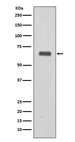 1 - Anti-C9/Complement Component C9 Rabbit Monoclonal Antibody ABO13214