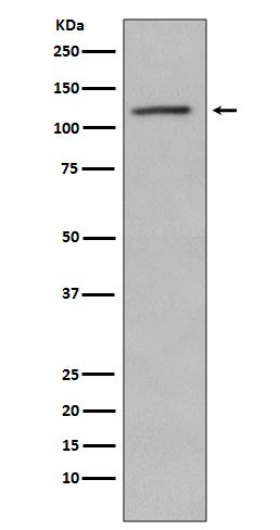 1 - Anti-Phospho-Retinoblastoma (S780) RB1 Rabbit Monoclonal Antibody ABO13215