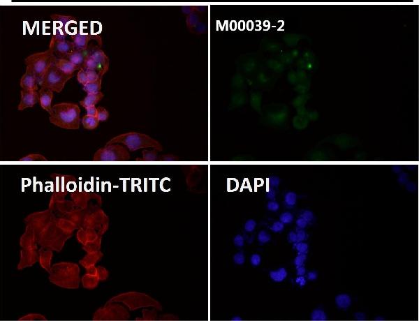 1 - Anti-Rb RB1 Rabbit Monoclonal Antibody ABO13216