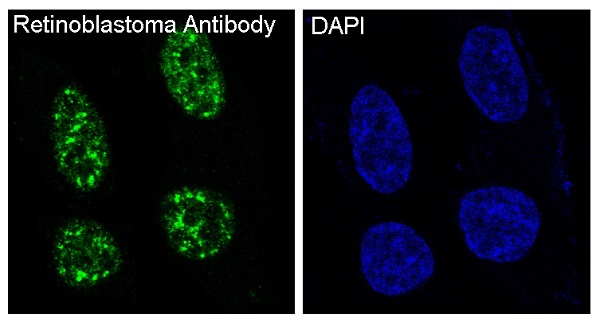 3 - Anti-Rb RB1 Rabbit Monoclonal Antibody ABO13216
