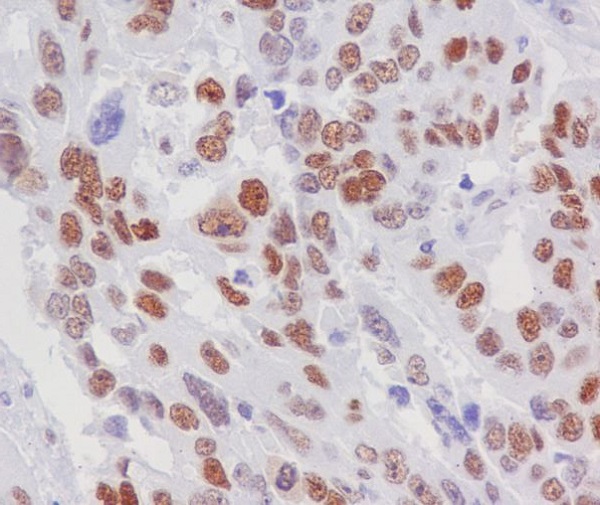 2 - Anti-Rb RB1 Rabbit Monoclonal Antibody ABO13216