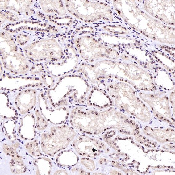 2 - Anti-Rb RB1 Rabbit Monoclonal Antibody ABO13216