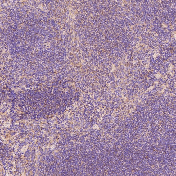 2 - Anti-Rb RB1 Rabbit Monoclonal Antibody ABO13216
