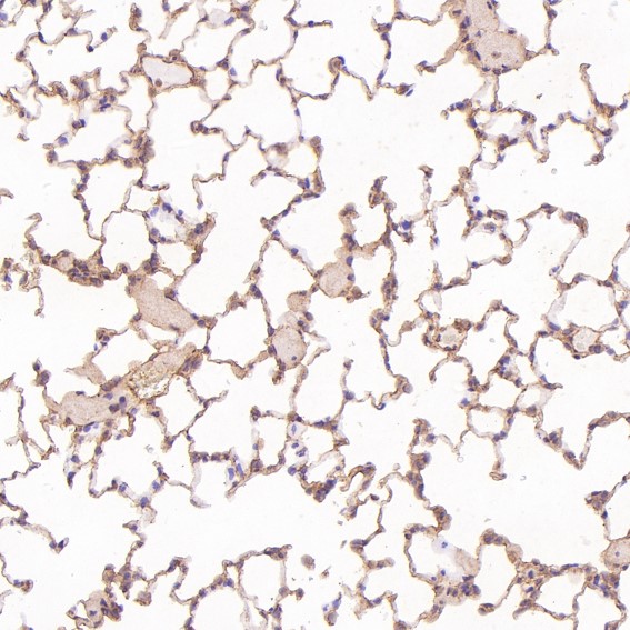2 - Anti-Rb RB1 Rabbit Monoclonal Antibody ABO13216
