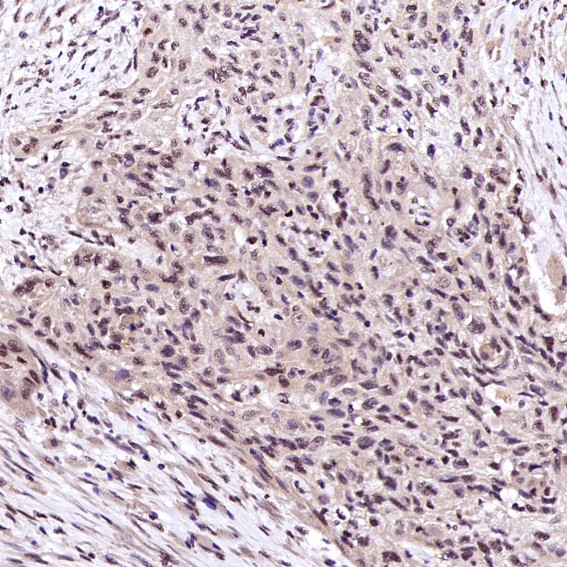 2 - Anti-Rb RB1 Rabbit Monoclonal Antibody ABO13216