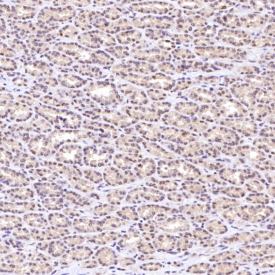 2 - Anti-Rb RB1 Rabbit Monoclonal Antibody ABO13216