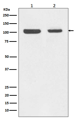 1 - Anti-Rb RB1 Rabbit Monoclonal Antibody ABO13216