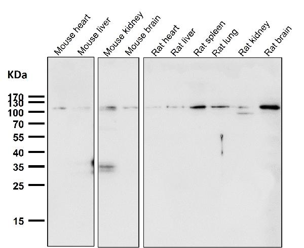 1 - Anti-Rb RB1 Rabbit Monoclonal Antibody ABO13216