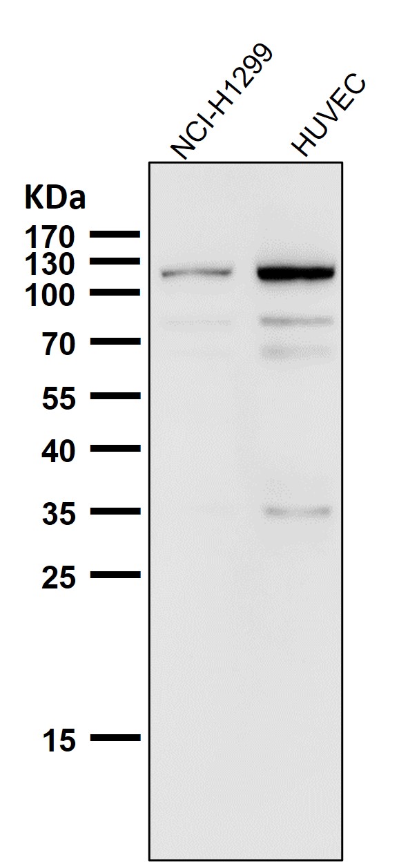 1 - Anti-Rb RB1 Rabbit Monoclonal Antibody ABO13216