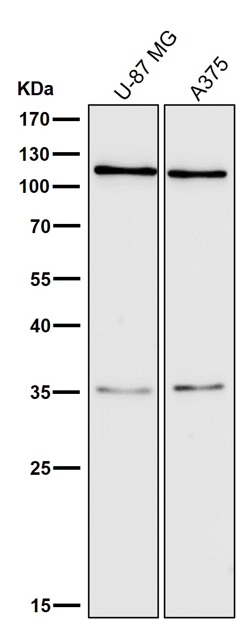 1 - Anti-C3/Complement C3 Rabbit Monoclonal Antibody ABO13218