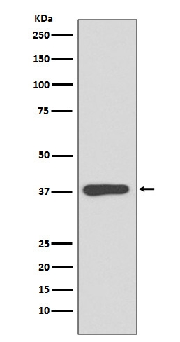 1 - Anti-MBP Rabbit Monoclonal Antibody ABO13219