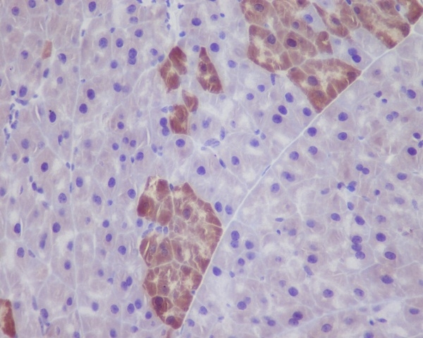 2 - Anti-GFP Rabbit Monoclonal Antibody ABO13220