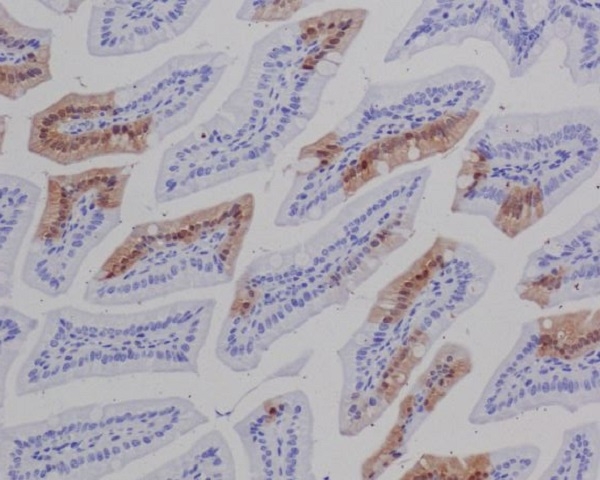 2 - Anti-GFP Rabbit Monoclonal Antibody ABO13221