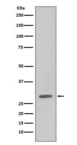 1 - Anti-GFP Rabbit Monoclonal Antibody ABO13222