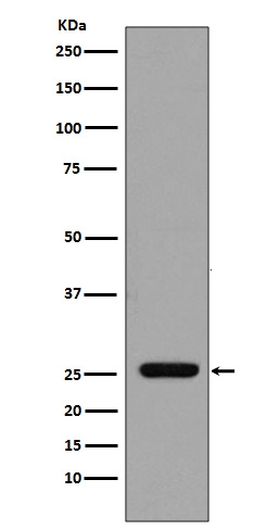 1 - Anti-GST GSTP1 Rabbit Monoclonal Antibody ABO13223