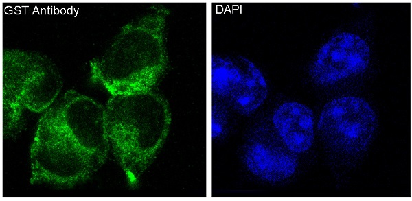 3 - Anti-GST GSTP1 Rabbit Monoclonal Antibody ABO13223