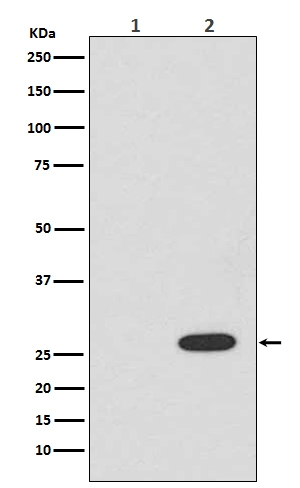 1 - Anti-RFP rfp1 Rabbit Monoclonal Antibody ABO13224
