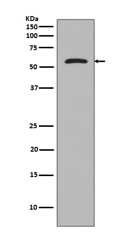 1 - Anti-Tau MAPT Rabbit Monoclonal Antibody ABO13225