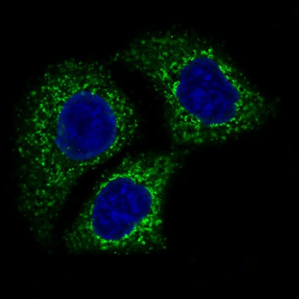 3 - Anti-AIF AIFM1 Rabbit Monoclonal Antibody ABO13226