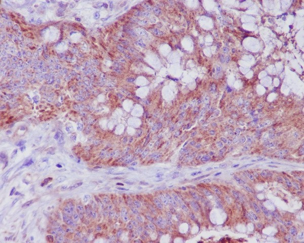 2 - Anti-Bax Rabbit Monoclonal Antibody ABO13227