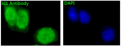 3 - Anti-Id1 Rabbit Monoclonal Antibody ABO13228