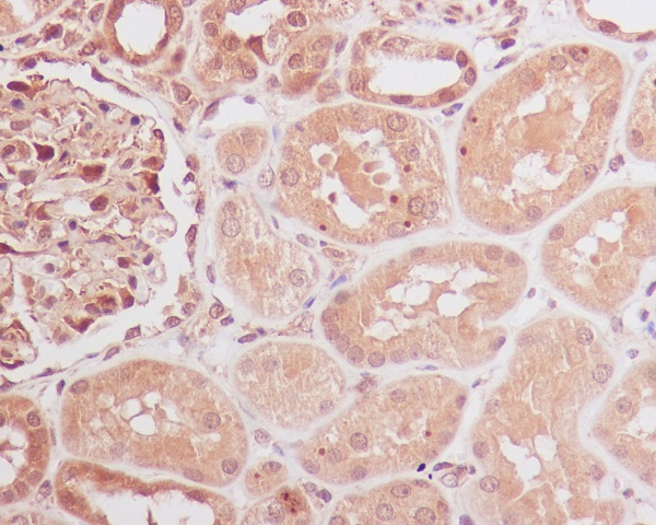 2 - Anti-Id1 Rabbit Monoclonal Antibody ABO13228