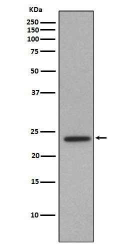 1 - Anti-Id1 Rabbit Monoclonal Antibody ABO13228