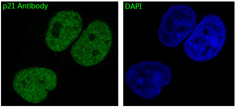 3 - Anti-p21 CDKN1A Rabbit Monoclonal Antibody ABO13229