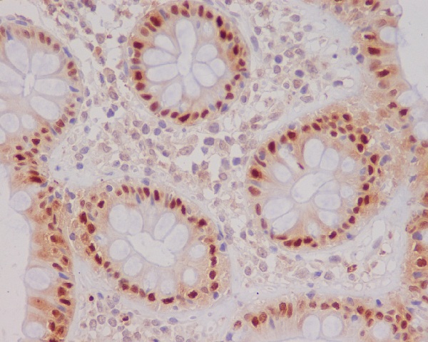 2 - Anti-p21 CDKN1A Rabbit Monoclonal Antibody ABO13229