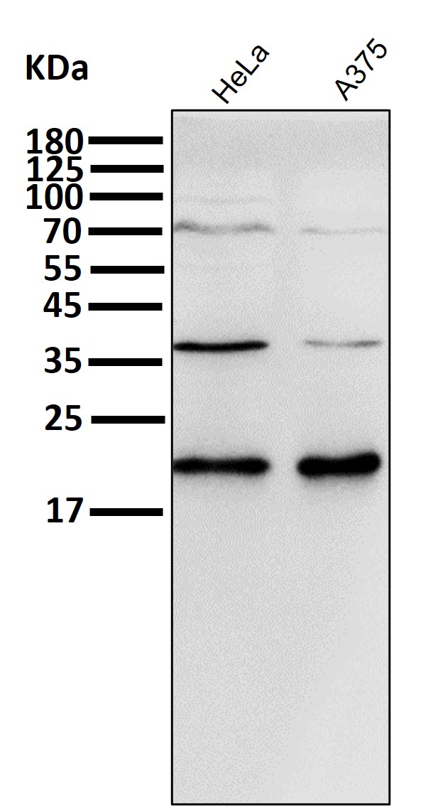 1 - Anti-p21 CDKN1A Rabbit Monoclonal Antibody ABO13229