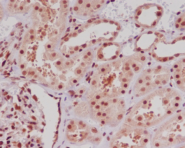 2 - Anti-ERG Rabbit Monoclonal Antibody ABO13230