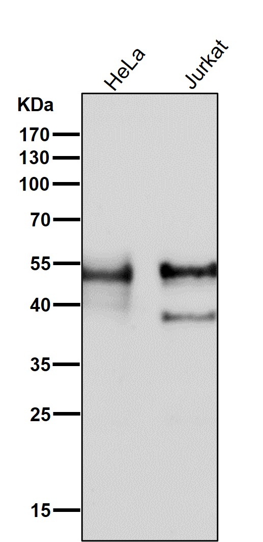 1 - Anti-ERG Rabbit Monoclonal Antibody ABO13230