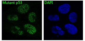 3 - Anti-p53 TP53 Rabbit Monoclonal Antibody ABO13231