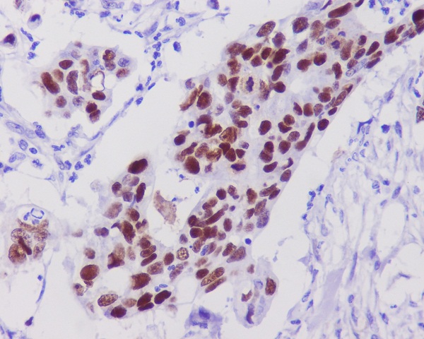 2 - Anti-p53 TP53 Rabbit Monoclonal Antibody ABO13231