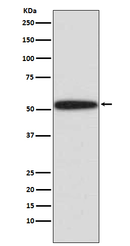 1 - Anti-p53 TP53 Rabbit Monoclonal Antibody ABO13231