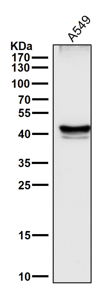 1 - Anti-p53 TP53 Rabbit Monoclonal Antibody ABO13231