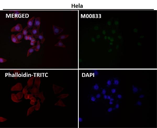 1 - Anti-YY1 Rabbit Monoclonal Antibody ABO13232