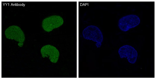 3 - Anti-YY1 Rabbit Monoclonal Antibody ABO13232