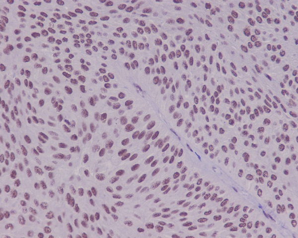2 - Anti-YY1 Rabbit Monoclonal Antibody ABO13232