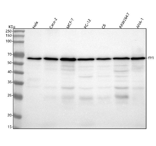 1 - Anti-YY1 Rabbit Monoclonal Antibody ABO13232