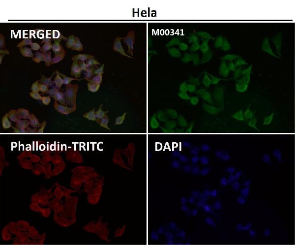 1 - Anti-NGF/Beta Ngf Rabbit Monoclonal Antibody ABO13233