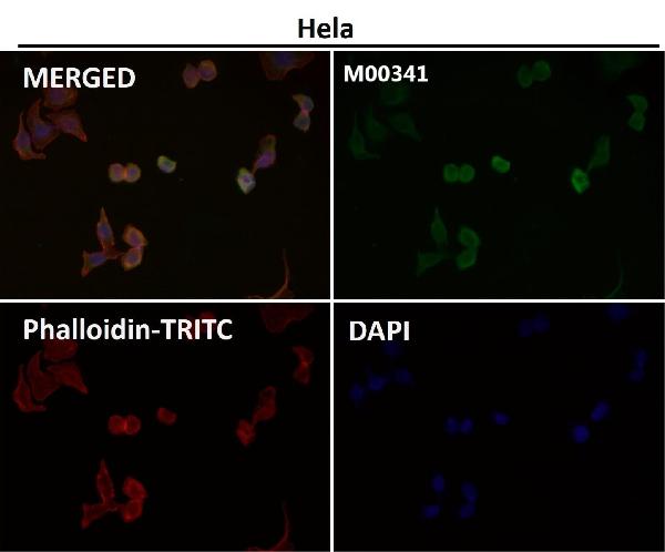 1 - Anti-NGF/Beta Ngf Rabbit Monoclonal Antibody ABO13233