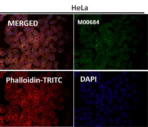 1 - Anti-Fyn Rabbit Monoclonal Antibody ABO13234