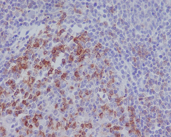 2 - Anti-PD1 PDCD1 Rabbit Monoclonal Antibody ABO13235