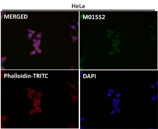 1 - Anti-Bim BCL2L11 Rabbit Monoclonal Antibody ABO13236