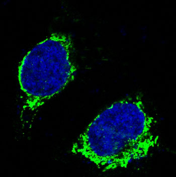 3 - Anti-Bim BCL2L11 Rabbit Monoclonal Antibody ABO13236