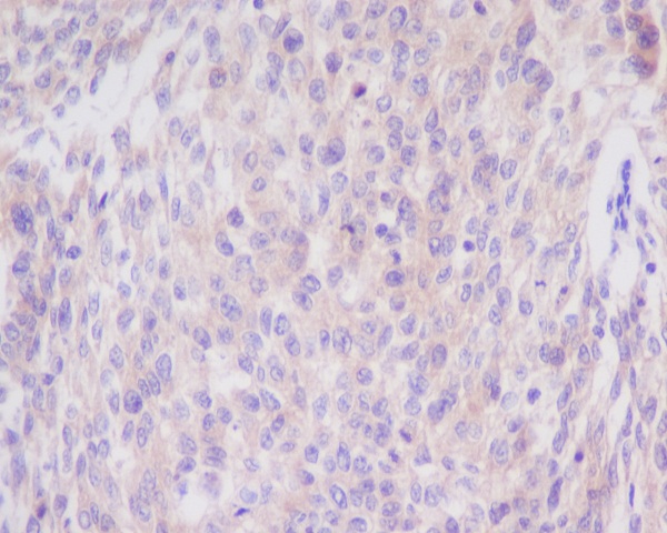 2 - Anti-Bim BCL2L11 Rabbit Monoclonal Antibody ABO13236